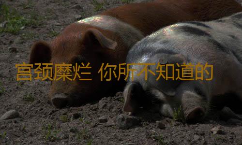 宫颈糜烂 你所不知道的六个误区
